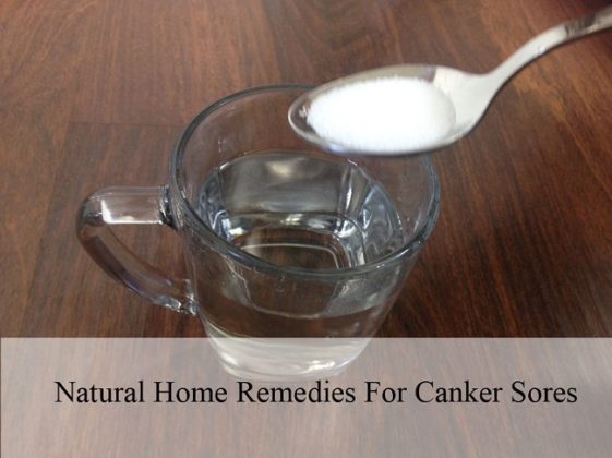natural-home-remedies-for-canker-sores-ritiriwaz
