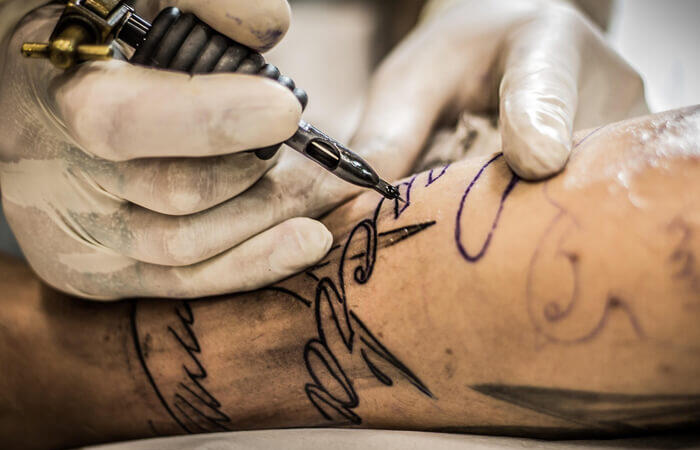 Top 8 Essential Steps in Laser Tattoo Removal Process